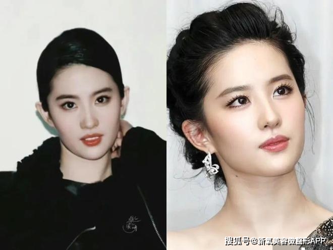 韩素希骨相美女_额头窄颧骨高的女明星_韩素希高颧骨审美